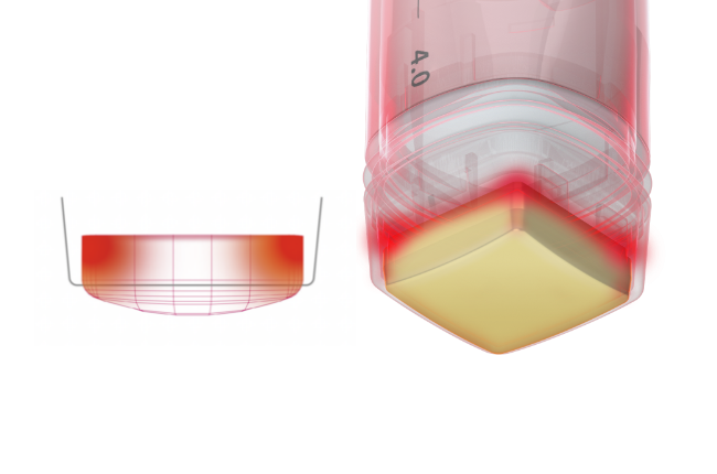 VOLNEWMER Hidden Edge Technology